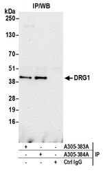 DRG1 Polyclonal Antibody