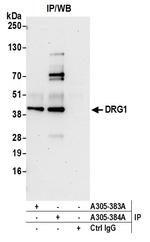 DRG1 Antibody in Immunoprecipitation (IP)