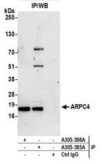 ARPC4 Polyclonal Antibody
