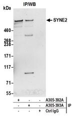 SYNE2/Nesprin 2 Antibody in Immunoprecipitation (IP)