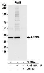 ARPC2 Antibody in Immunoprecipitation (IP)