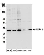 ARPC2 Polyclonal Antibody