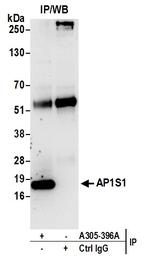 AP1S1 Antibody in Immunoprecipitation (IP)