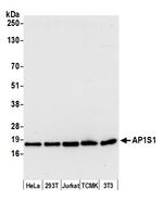 AP1S1 Antibody in Western Blot (WB)