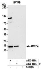 ARPC4 Antibody in Immunoprecipitation (IP)