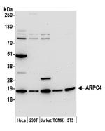 ARPC4 Polyclonal Antibody