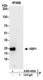 VBP1 Antibody in Immunoprecipitation (IP)