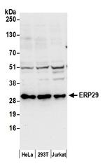 ERP29 Polyclonal Antibody