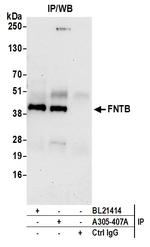 FNTB Polyclonal Antibody