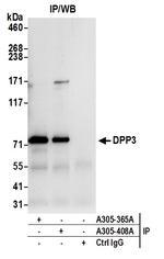 DPP3 Antibody in Immunoprecipitation (IP)