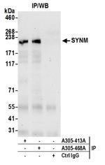 SYNM Antibody in Immunoprecipitation (IP)