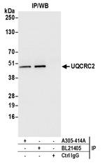UQCRC2 Antibody in Immunoprecipitation (IP)