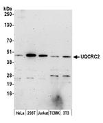 UQCRC2 Polyclonal Antibody