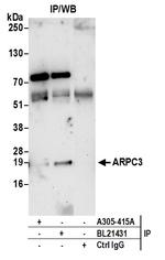 ARPC3 Antibody in Immunoprecipitation (IP)