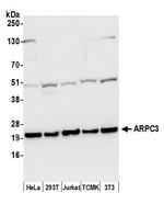 ARPC3 Polyclonal Antibody
