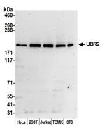 UBR2 Polyclonal Antibody