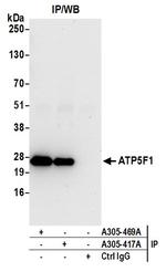 ATP5F1 Antibody in Immunoprecipitation (IP)