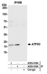 ATP5O Polyclonal Antibody