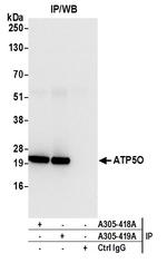 ATP5O Antibody in Immunoprecipitation (IP)