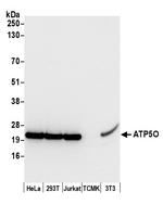 ATP5O Polyclonal Antibody