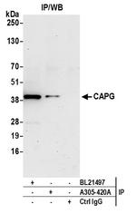 CAPG Antibody in Immunoprecipitation (IP)