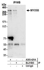 MYO5B Polyclonal Antibody