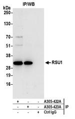 RSU1 Antibody in Immunoprecipitation (IP)