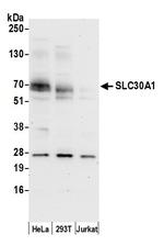 SLC30A1/ZNT1 Polyclonal Antibody