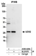 UCK2 Polyclonal Antibody
