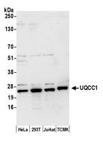 UQCC1 Polyclonal Antibody
