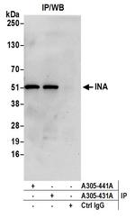INA Polyclonal Antibody