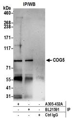 COG5 Polyclonal Antibody