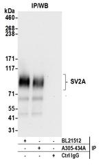 SV2A/SV2 Antibody in Immunoprecipitation (IP)