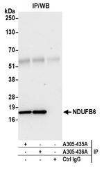 NDUFB6 Antibody in Immunoprecipitation (IP)