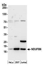 NDUFB6 Polyclonal Antibody