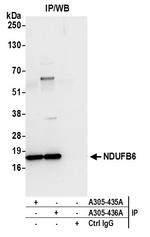 NDUFB6 Antibody in Immunoprecipitation (IP)