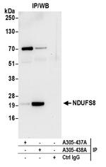 NDUFS8 Antibody in Immunoprecipitation (IP)