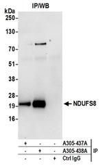 NDUFS8 Antibody in Immunoprecipitation (IP)
