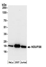 NDUFS8 Polyclonal Antibody