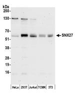 SNX27 Polyclonal Antibody