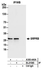 SRPRB Antibody in Immunoprecipitation (IP)