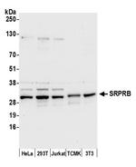 SRPRB Polyclonal Antibody