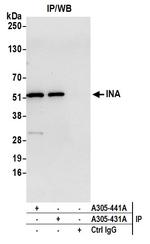 INA Polyclonal Antibody