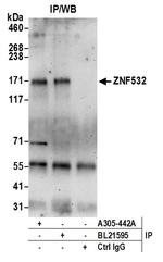 ZNF532 Polyclonal Antibody