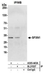 SFXN1 Antibody in Immunoprecipitation (IP)