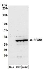 SFXN1 Polyclonal Antibody