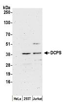 DCPS Polyclonal Antibody