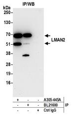 LMAN2 Polyclonal Antibody