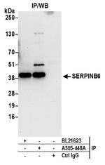 SERPINB6 Polyclonal Antibody