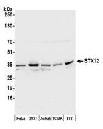 STX12 Antibody in Western Blot (WB)